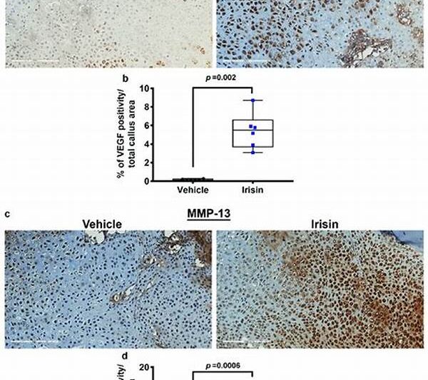 Immunostaining
