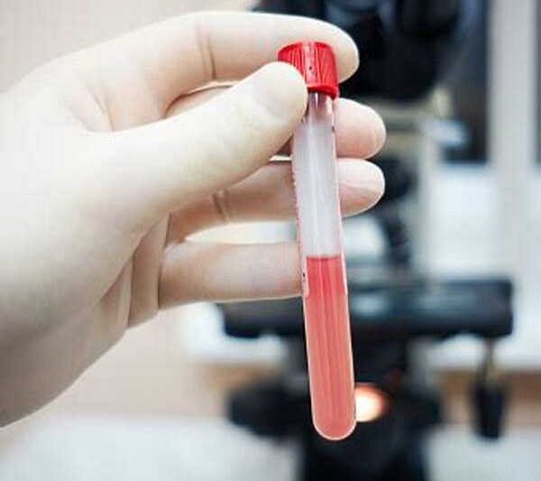 Uji Darah